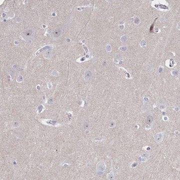 Anti-CENPT antibody produced in rabbit Prestige Antibodies&#174; Powered by Atlas Antibodies, affinity isolated antibody, buffered aqueous glycerol solution