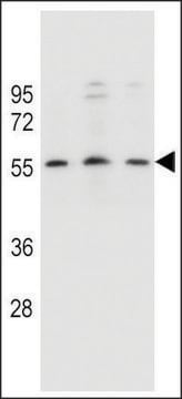 ANTI-KCNK18 (CENTER) antibody produced in rabbit affinity isolated antibody, buffered aqueous solution