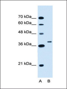 Anti-RNF146 antibody produced in rabbit IgG fraction of antiserum