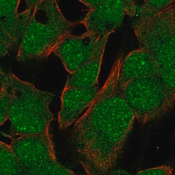 Anti-Tbx10 Antibody Produced In Rabbit Prestige Antibodies&#174; Powered by Atlas Antibodies, affinity isolated antibody, buffered aqueous glycerol solution