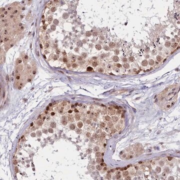 Anti-TCOF1 antibody produced in rabbit Prestige Antibodies&#174; Powered by Atlas Antibodies, affinity isolated antibody, buffered aqueous glycerol solution