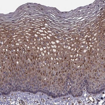 Anti-TRIP10 antibody produced in rabbit Prestige Antibodies&#174; Powered by Atlas Antibodies, affinity isolated antibody