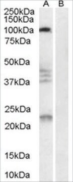 Anti-NOGO 66 Receptor antibody produced in goat affinity isolated antibody, buffered aqueous solution