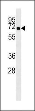 ANTI-ATG16L antibody produced in rabbit purified immunoglobulin, buffered aqueous solution