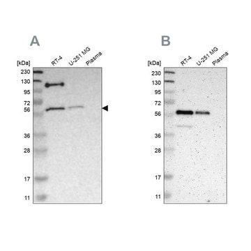 Anti-TRAF2 antibody produced in rabbit Ab2, Prestige Antibodies&#174; Powered by Atlas Antibodies, affinity isolated antibody, buffered aqueous glycerol solution