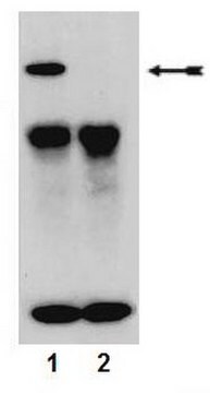 Anti-phospho-PKC&#945; (Ser657/Tyr658) Antibody Upstate&#174;, from rabbit