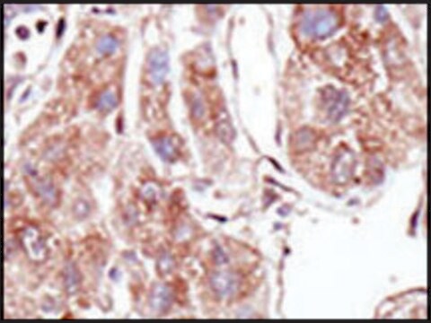 Anti-PIASz1 (C-term) antibody produced in rabbit IgG fraction of antiserum, buffered aqueous solution