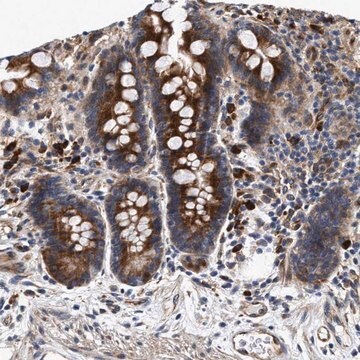 Anti-IFT74 antibody produced in rabbit Prestige Antibodies&#174; Powered by Atlas Antibodies, affinity isolated antibody, buffered aqueous glycerol solution, Ab1