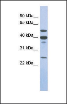 Anti-MMP13 antibody produced in rabbit affinity isolated antibody