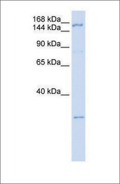 Anti-ZNF687 antibody produced in rabbit affinity isolated antibody