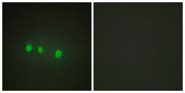 Anti-ZIC1 antibody produced in rabbit affinity isolated antibody