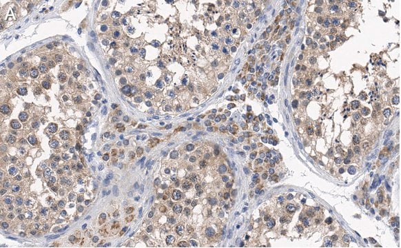 Anti-PGAM5 Antibody, clone 2J4 ZooMAb&#174; Rabbit Monoclonal recombinant, expressed in HEK 293 cells