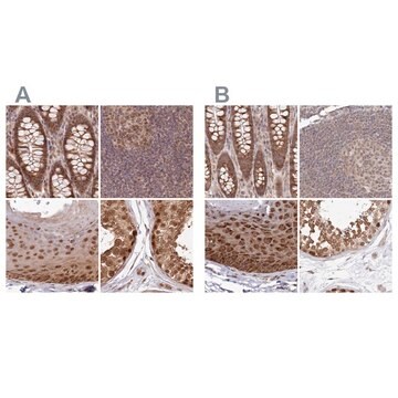 Anti-WAPL antibody produced in rabbit Prestige Antibodies&#174; Powered by Atlas Antibodies, affinity isolated antibody, buffered aqueous glycerol solution