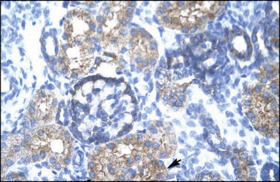 Anti-TRIM15 antibody produced in rabbit IgG fraction of antiserum