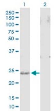 Anti-SNAP25 antibody produced in mouse purified immunoglobulin, buffered aqueous solution