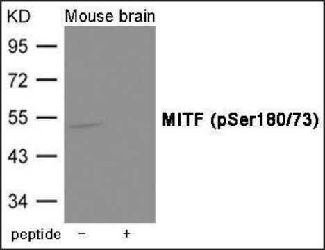 Anti-phospho-MITF (pSer180/73) antibody produced in rabbit affinity isolated antibody