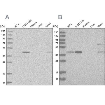 Anti-RTCA antibody produced in rabbit Prestige Antibodies&#174; Powered by Atlas Antibodies, affinity isolated antibody