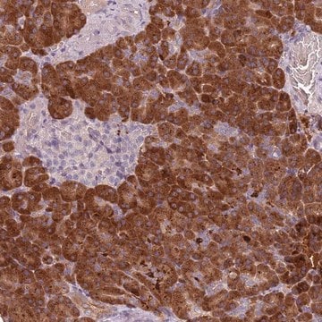 Anti-TLCD2 antibody produced in rabbit Prestige Antibodies&#174; Powered by Atlas Antibodies, affinity isolated antibody, buffered aqueous glycerol solution