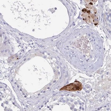 Anti-NT5C3B antibody produced in rabbit Prestige Antibodies&#174; Powered by Atlas Antibodies, affinity isolated antibody, buffered aqueous glycerol solution