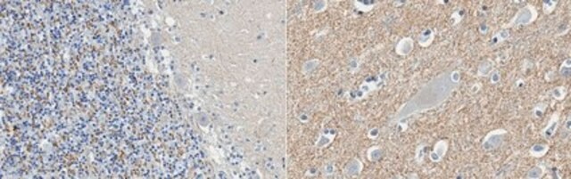 Anti-Catenin Delta-2 Antibody, clone 12B4 clone 12B4.1, from mouse