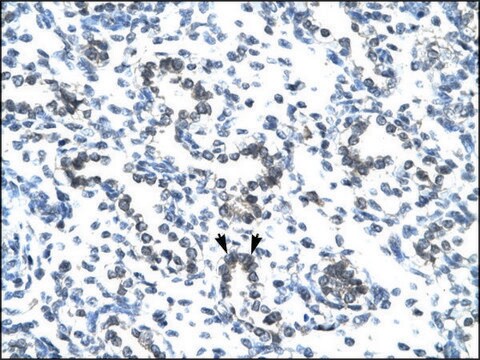 Anti-EVX1 antibody produced in rabbit IgG fraction of antiserum