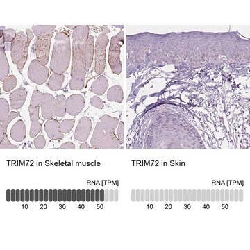 Anti-TRIM72 antibody produced in rabbit Prestige Antibodies&#174; Powered by Atlas Antibodies, affinity isolated antibody, buffered aqueous glycerol solution