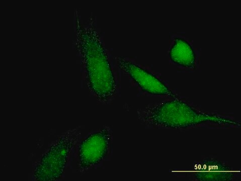 Monoclonal Anti-ABCC11 antibody produced in mouse clone 4H6, purified immunoglobulin, buffered aqueous solution