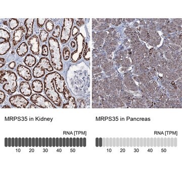 Anti-MRPS35 antibody produced in rabbit Prestige Antibodies&#174; Powered by Atlas Antibodies, affinity isolated antibody, buffered aqueous glycerol solution