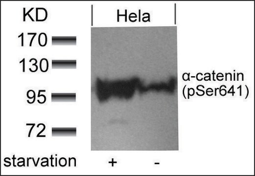 Anti-phospho-CTNNA1 (pSer641) antibody produced in rabbit affinity isolated antibody