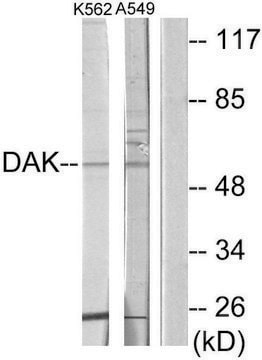 Anti-DAK antibody produced in rabbit affinity isolated antibody