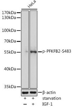 Anti-Phospho-PFKFB2-S483 antibody produced in rabbit