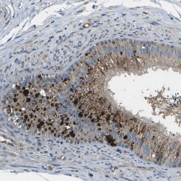 Anti-PXYLP1 antibody produced in rabbit Prestige Antibodies&#174; Powered by Atlas Antibodies, affinity isolated antibody, buffered aqueous glycerol solution