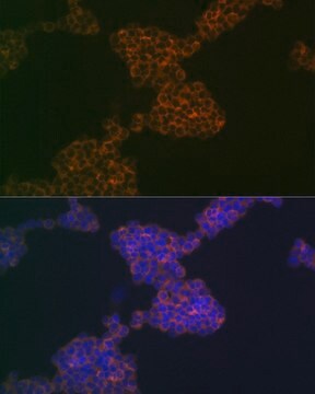 Anti-CD3G antibody produced in rabbit