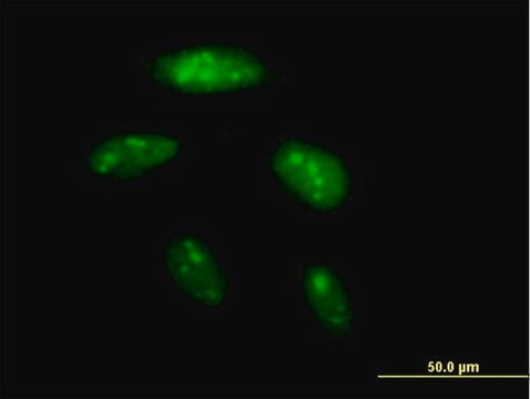 Anti-BAZ2B antibody produced in mouse IgG fraction of antiserum, buffered aqueous solution