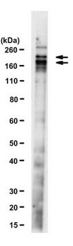 Anti-ESET (SETDB1) Antibody, clone F0808 clone F0808, from mouse