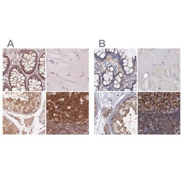 Anti-ANKRD13A antibody produced in rabbit Prestige Antibodies&#174; Powered by Atlas Antibodies, affinity isolated antibody, buffered aqueous glycerol solution