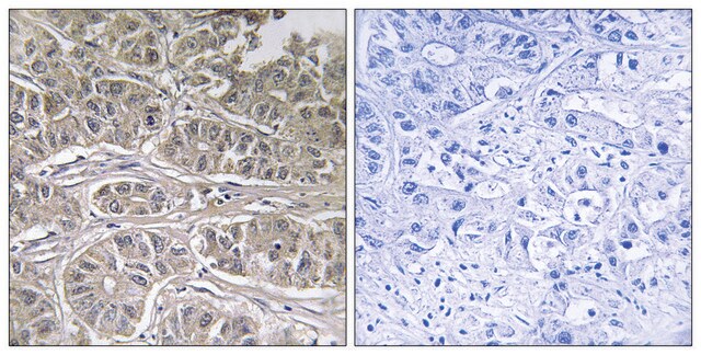 Anti-SLC25A21 antibody produced in rabbit affinity isolated antibody