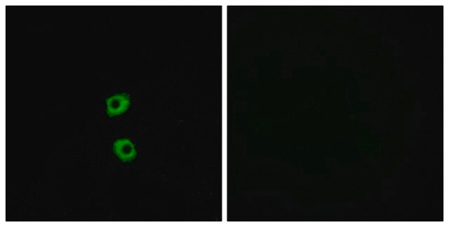 Anti-FZD7 antibody produced in rabbit affinity isolated antibody