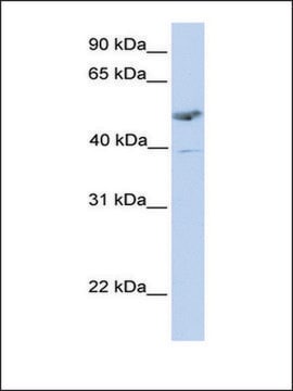 Anti-ST3GAL1 antibody produced in rabbit affinity isolated antibody