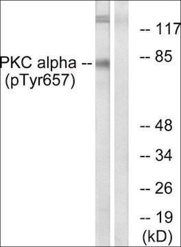 Anti-phospho-PKC &#945; (pTyr657) antibody produced in rabbit affinity isolated antibody