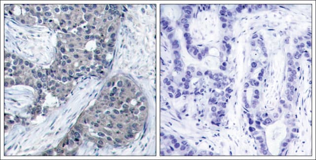 Anti-phospho-EIF4E (pSer209) antibody produced in rabbit affinity isolated antibody