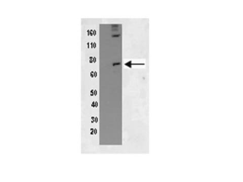 Anti-Phospho-PKR(Thr451)-Antikörper Upstate&#174;, from rabbit