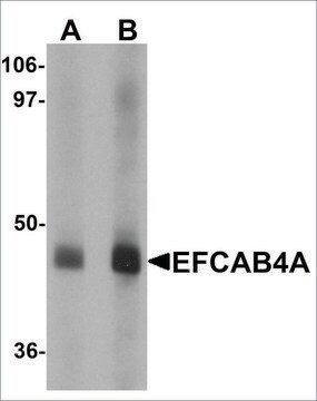 Anti-EFCAB4A antibody produced in rabbit affinity isolated antibody, buffered aqueous solution