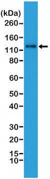 Anti-N-Cadherin (CDH2) antibody, Rabbit monoclonal recombinant, expressed in HEK 293 cells, clone RM259, purified immunoglobulin