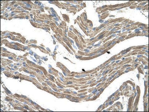 Anti-ASPN (AB3) antibody produced in rabbit IgG fraction of antiserum