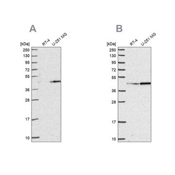 Anti-WDR18 antibody produced in rabbit Prestige Antibodies&#174; Powered by Atlas Antibodies, affinity isolated antibody, buffered aqueous glycerol solution