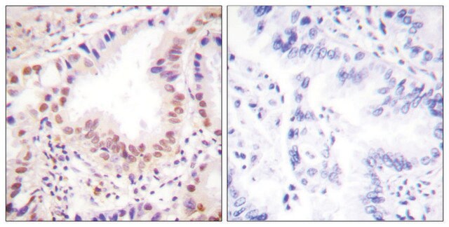 Anti-ETS1 antibody produced in rabbit affinity isolated antibody