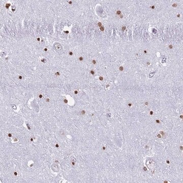 Anti-RYK antibody produced in rabbit Prestige Antibodies&#174; Powered by Atlas Antibodies, affinity isolated antibody, buffered aqueous glycerol solution