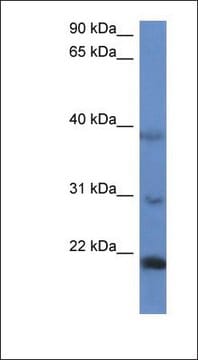 Anti-IMMP2L antibody produced in rabbit affinity isolated antibody