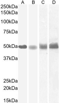 Anti-IDO2 (C-terminal) antibody produced in goat affinity isolated antibody, buffered aqueous solution